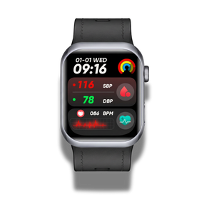 1 watch